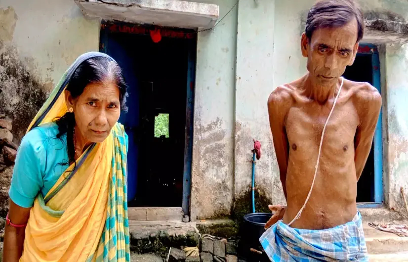 Deformed bodies & yellowing teeth: Fluoride contamination in water major health hazard in rural Jharkhand